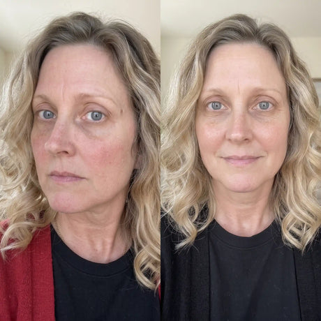 Skinora Radiance Face før og etter – mindre synlige pigmentflekker og fine linjer, jevnere hudtone og mer glød etter 8 ukers bruk.