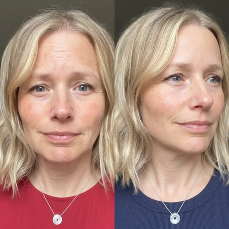 Skinora Radiance Face før og etter – jevnere hudtone, synlig falmede aldersflekker og mer glød på kinnene etter 8 ukers bruk. Testpanel, resultater varierer.