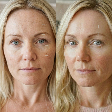 Skinora Radiance Face før og etter – mindre synlige pigmentflekker og fine linjer, jevnere hudtone og mer glød etter 8 ukers bruk.