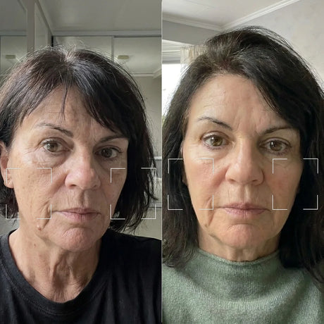 Skinora Radiance Face før og etter – jevnere hudtone, synlig falmede aldersflekker og mer glød på kinnene etter 8 ukers bruk. Testpanel, resultater varierer.