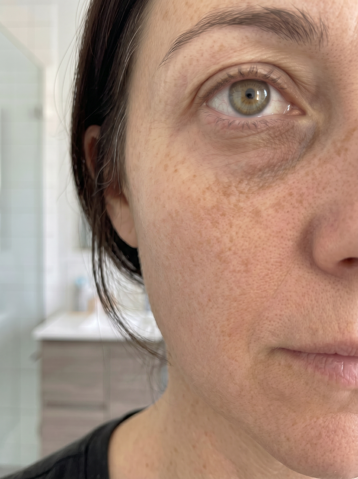 Ingrid, 44 – etter 8 uker med Skinora Radiance Face