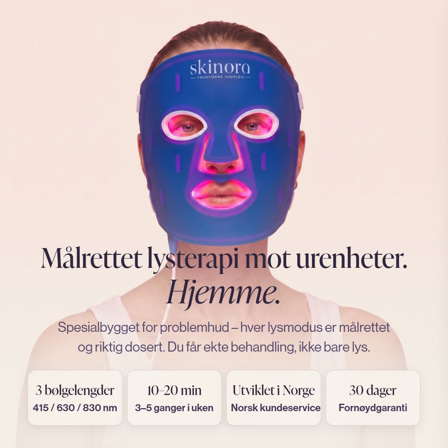 Skinora Clear LED-maske gir malrettet lysterapi mot urenheter i huden, hjemme LED light therapy device